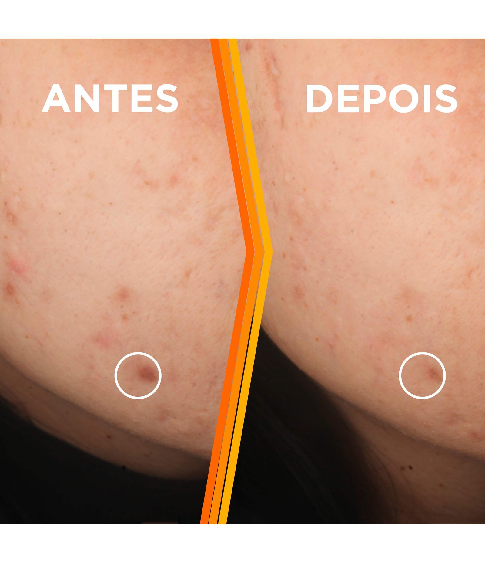 Sérum Facial Antimarcas Garnier Uniform & Matte Vitamina C, 30ml 30ml 6