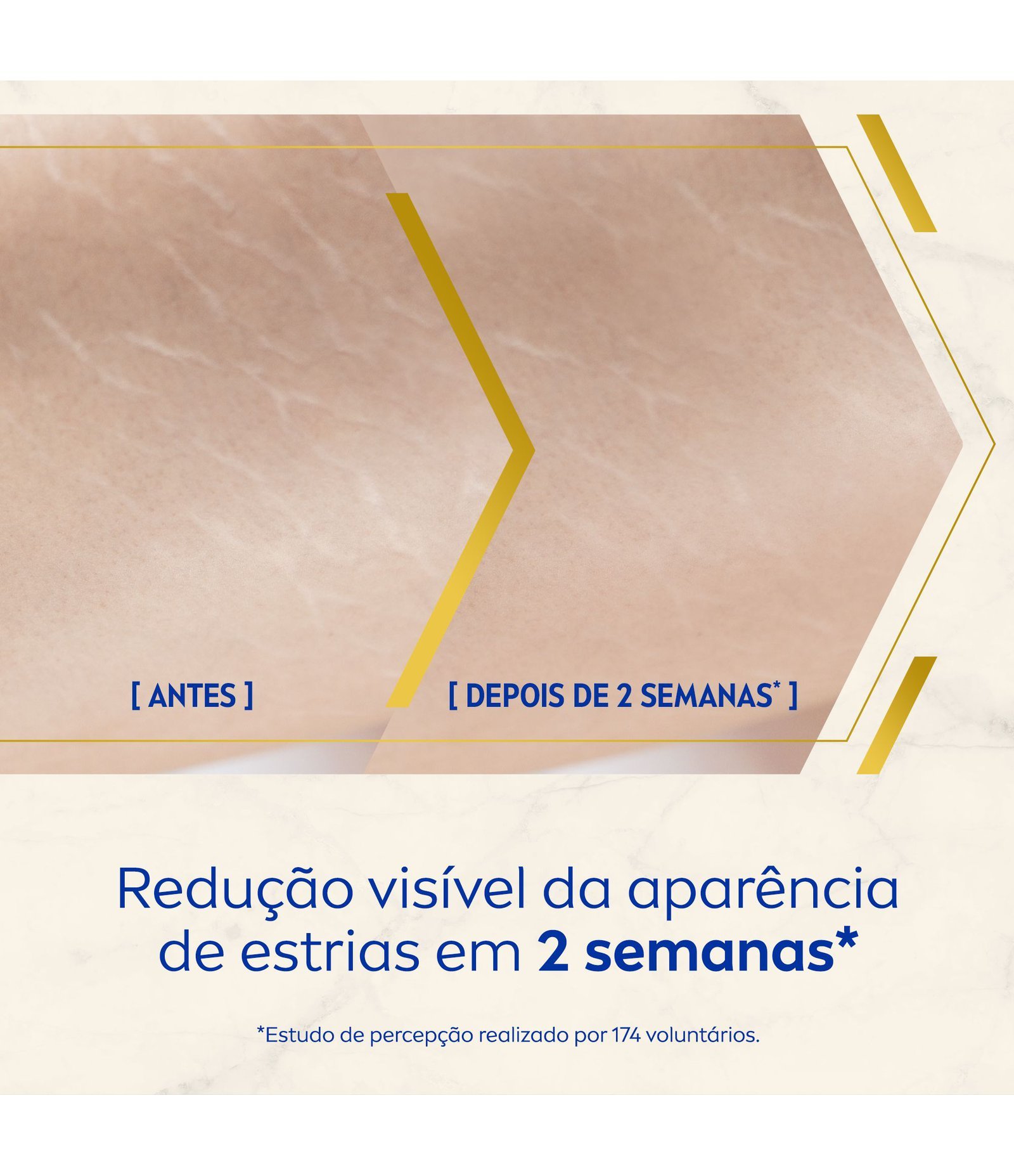 Sérum Óleo Corporal Antiestrias Luminous 630 Nivea 100ml 5